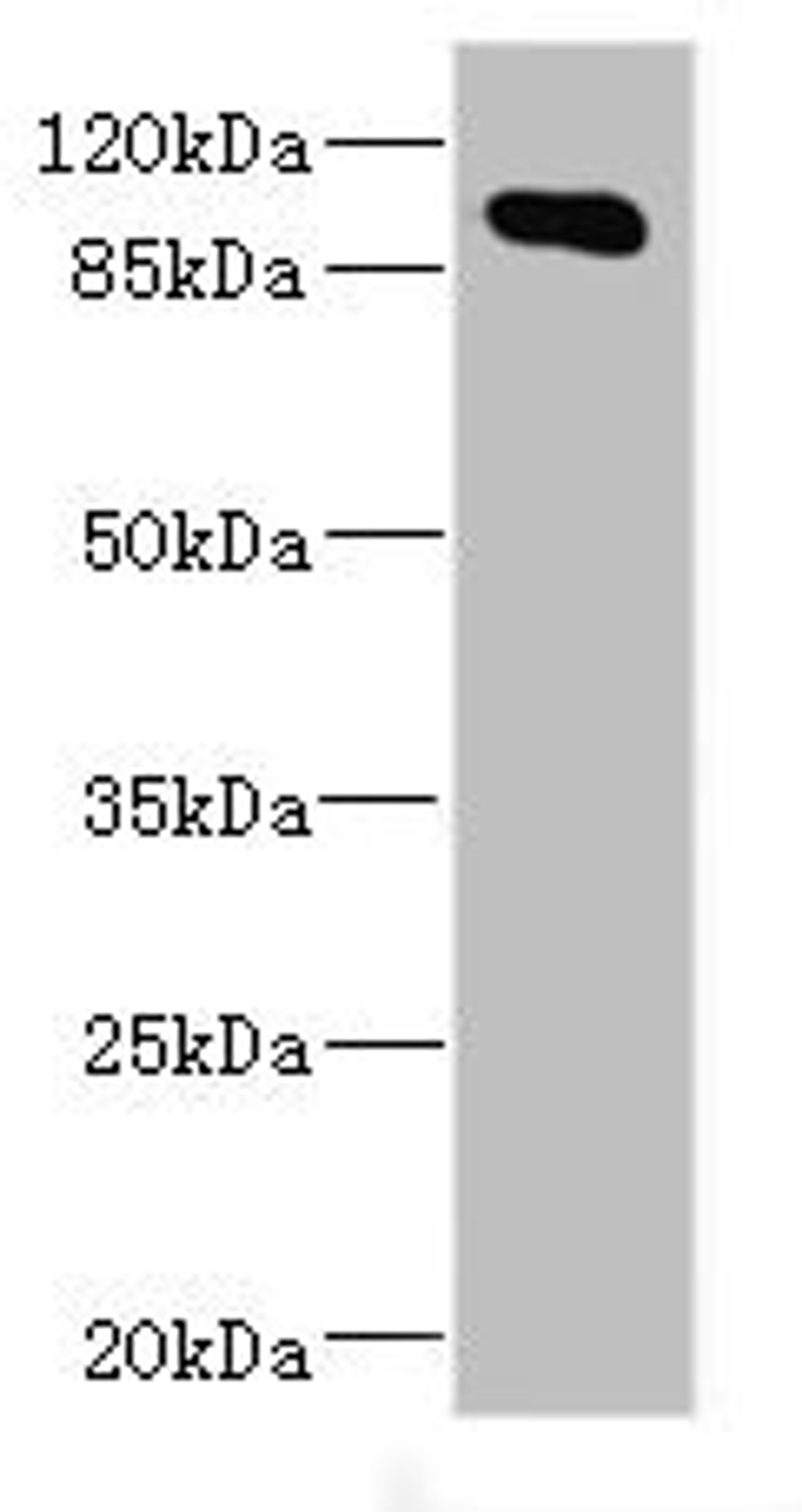 Western blot. All lanes: MAP4K5 antibody at 4.2ug/ml + Mouse brain tissue. Secondary. Goat polyclonal to rabbit IgG at 1/10000 dilution. Predicted band size: 95 kDa. Observed band size: 95 kDa. 