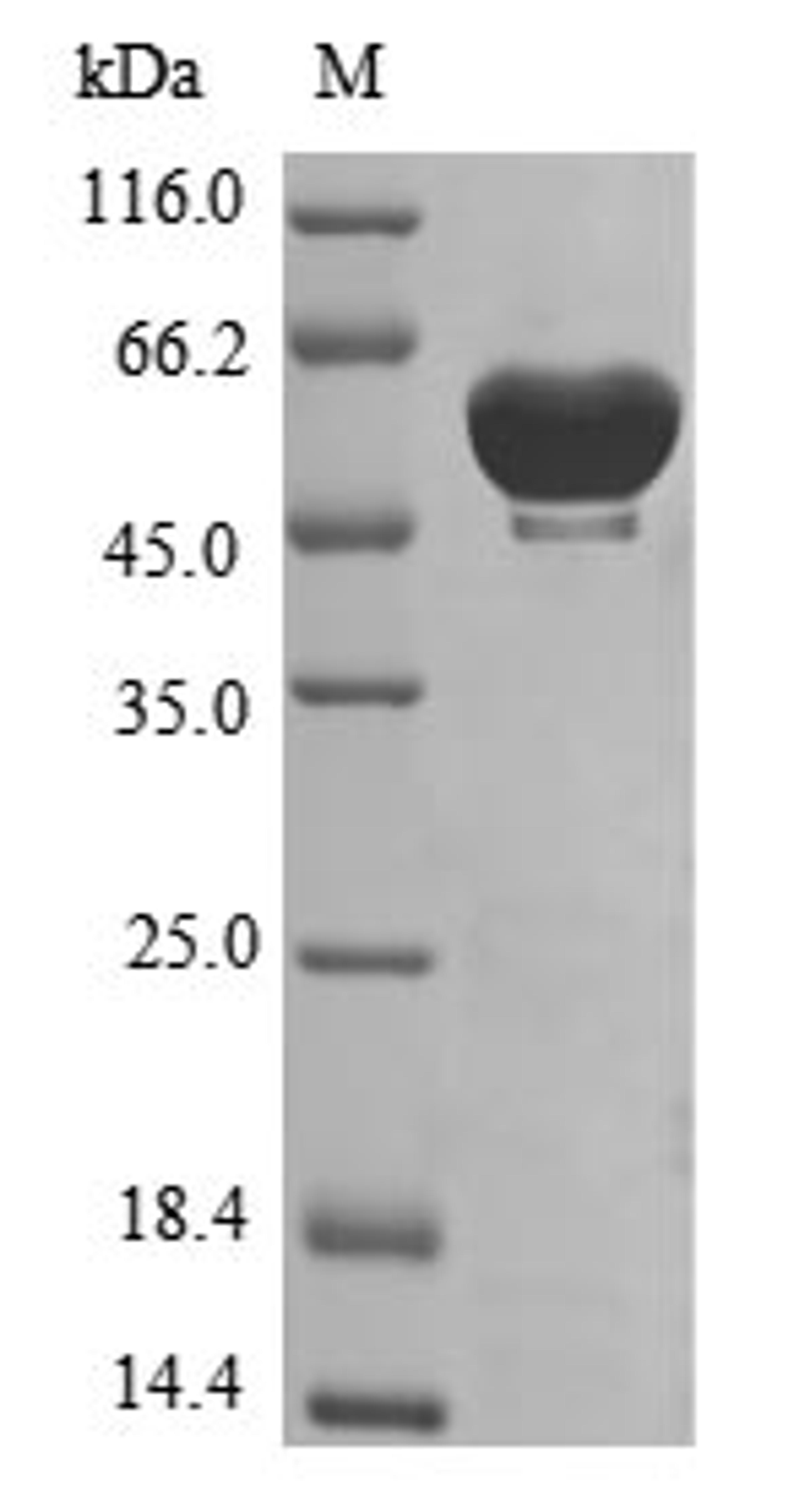 (Tris-Glycine gel) Discontinuous SDS-PAGE (reduced) with 5% enrichment gel and 15% separation gel.