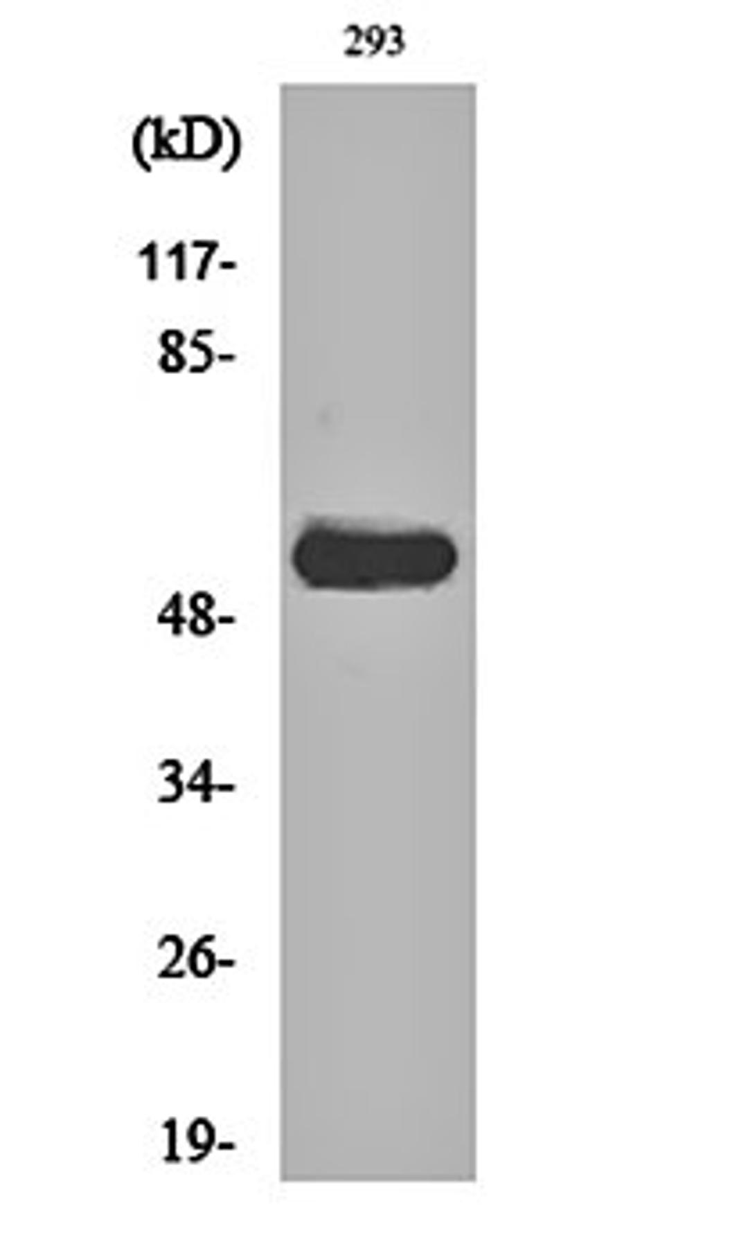 Western blot analysis of 293 cell lysates using c-Src (phospho-Y419) antibody