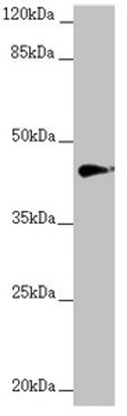Western blot. All lanes: RNF13 antibody at 1.22µg/ml + MCF-7 whole cell lysate. Secondary. Goat polyclonal to rabbit IgG at 1/10000 dilution. Predicted band size: 43, 30 kDa. Observed band size: 43 kDa