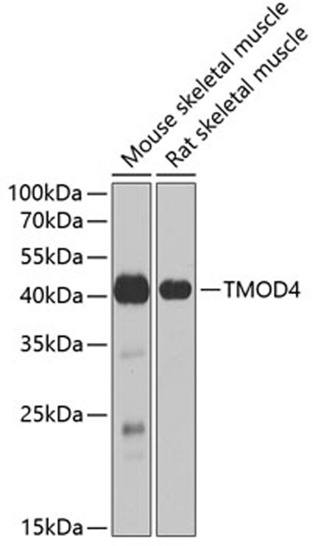 Western blot - TMOD4 antibody (A6772)