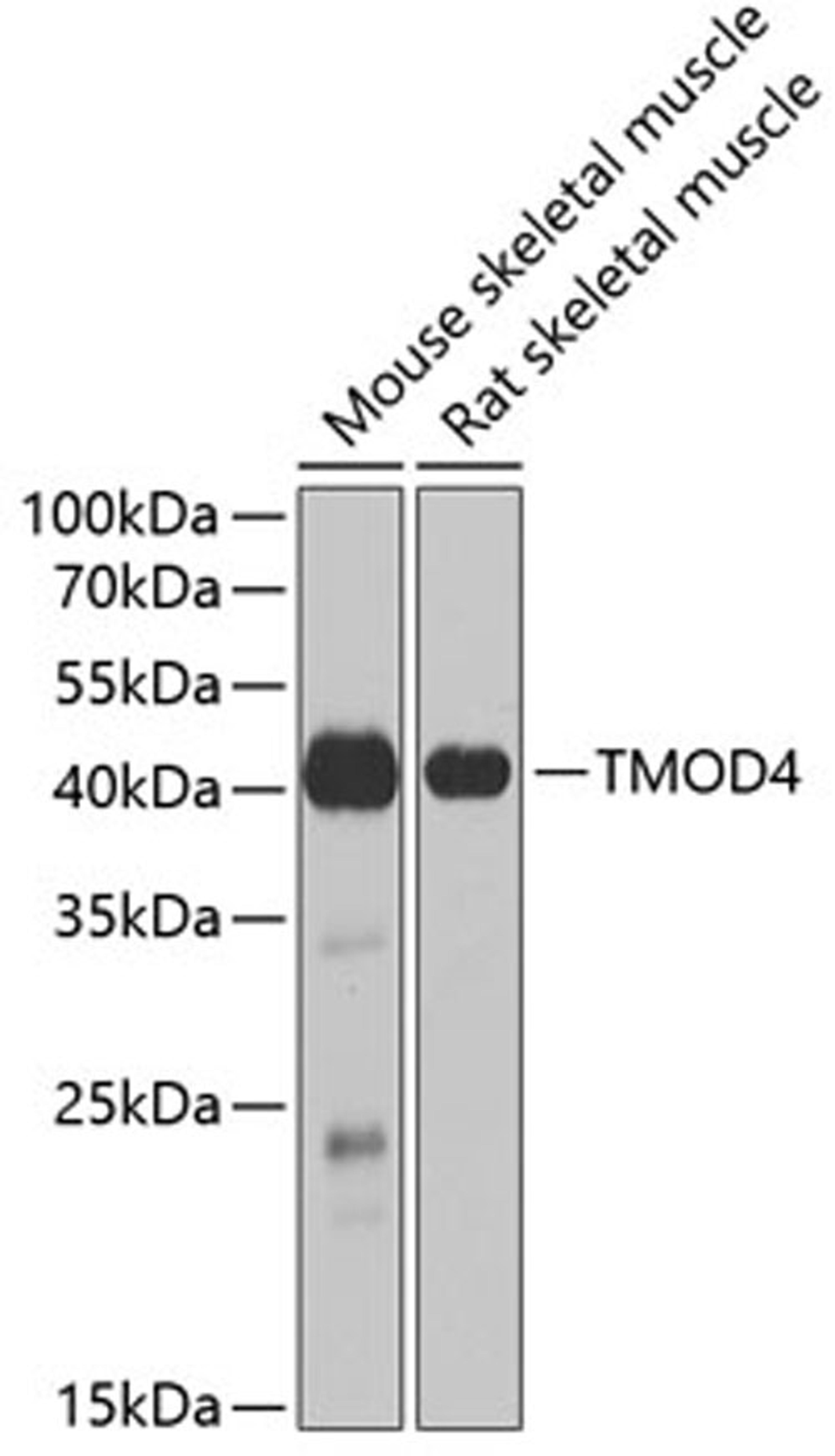 Western blot - TMOD4 antibody (A6772)