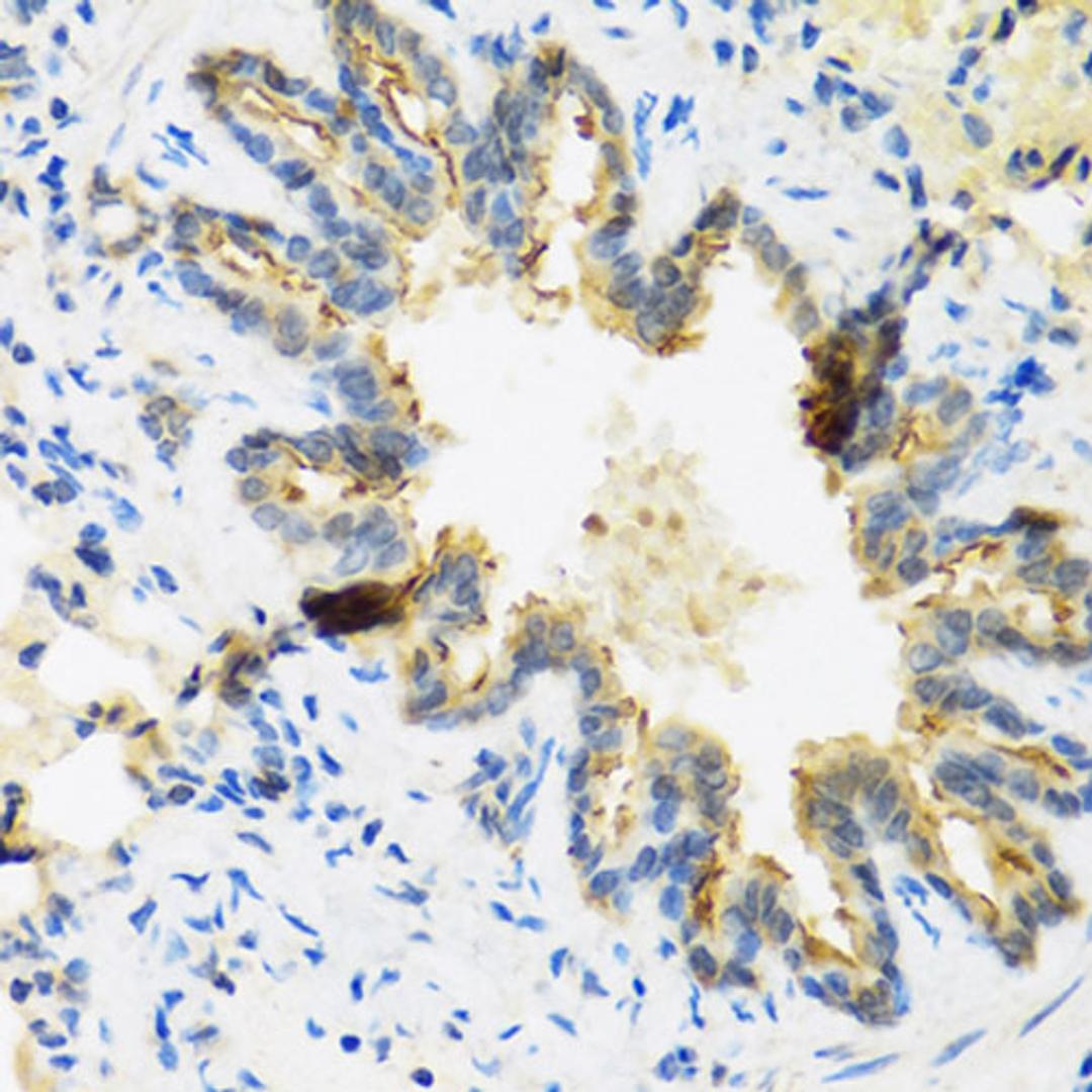 Immunohistochemistry  - DEFB4A antibody (A1643)