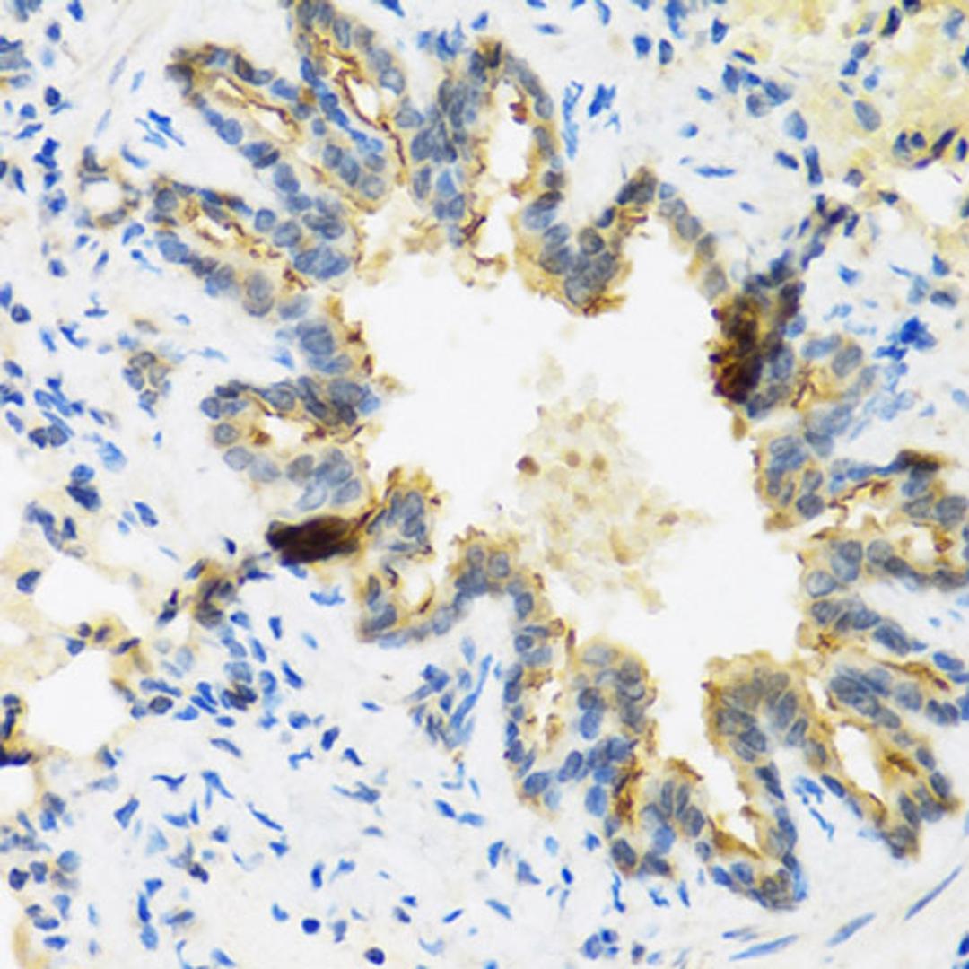 Immunohistochemistry - DEFB4A antibody (A1643)