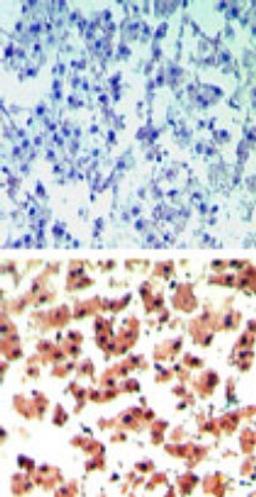 Immunohistochemistry-Paraffin: RGS19 Antibody [NBP2-24516] - analysis of RGS19 in paraffin-embedded formalin-fixed human liver tissue using an isotype control (top) and this antibody (bottom) at 5 ug/ml.