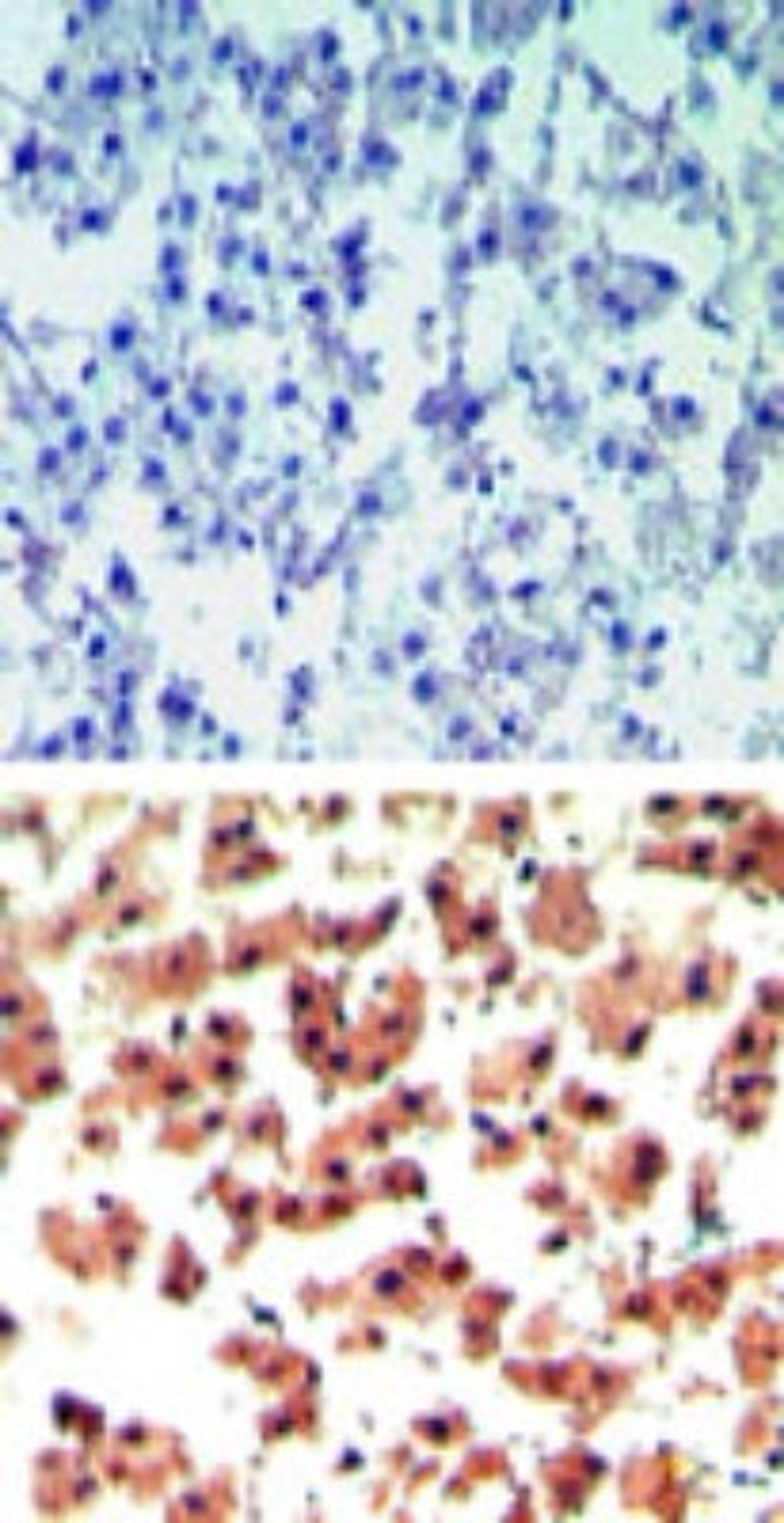 Immunohistochemistry-Paraffin: RGS19 Antibody [NBP2-24516] - analysis of RGS19 in paraffin-embedded formalin-fixed human liver tissue using an isotype control (top) and this antibody (bottom) at 5 ug/ml.