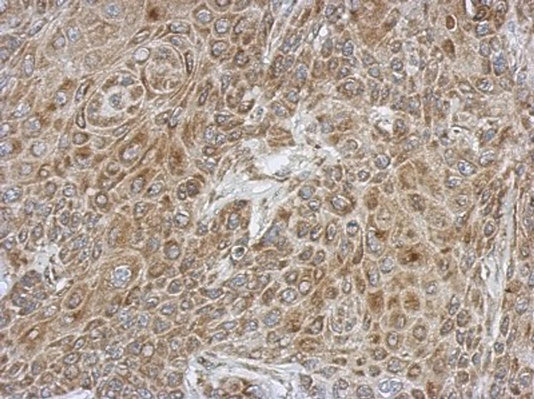 Immunohistochemistry-Paraffin: ATP5L Antibody [NBP2-15515] - Immunohistochemical analysis of paraffin-embedded Cal27 xenograft, using antibody at 1:500 dilution.