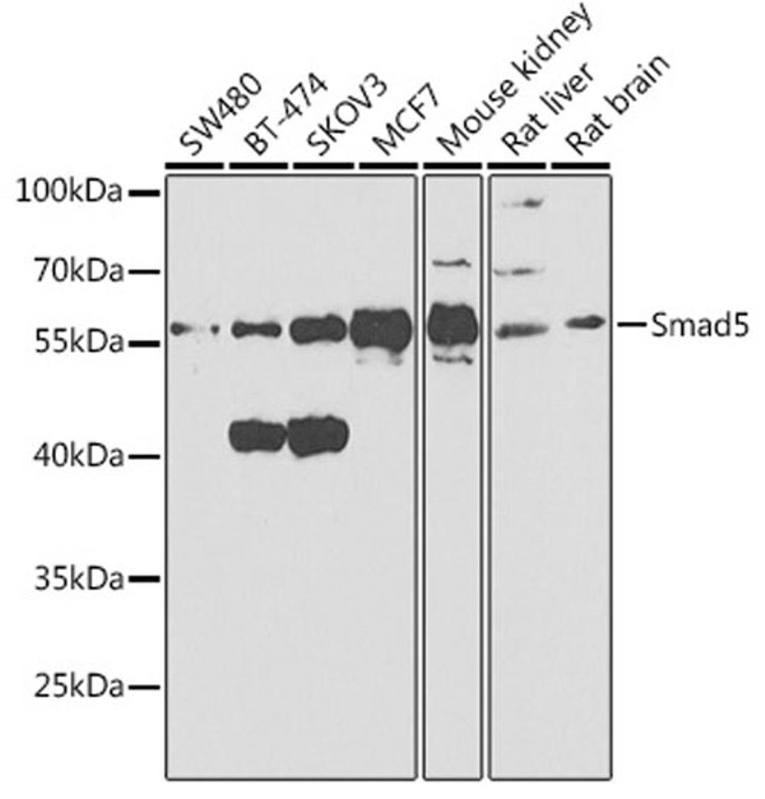 Western blot - Smad5 antibody (A1947)