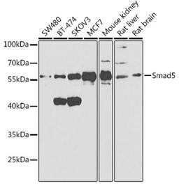 Western blot - Smad5 antibody (A1947)