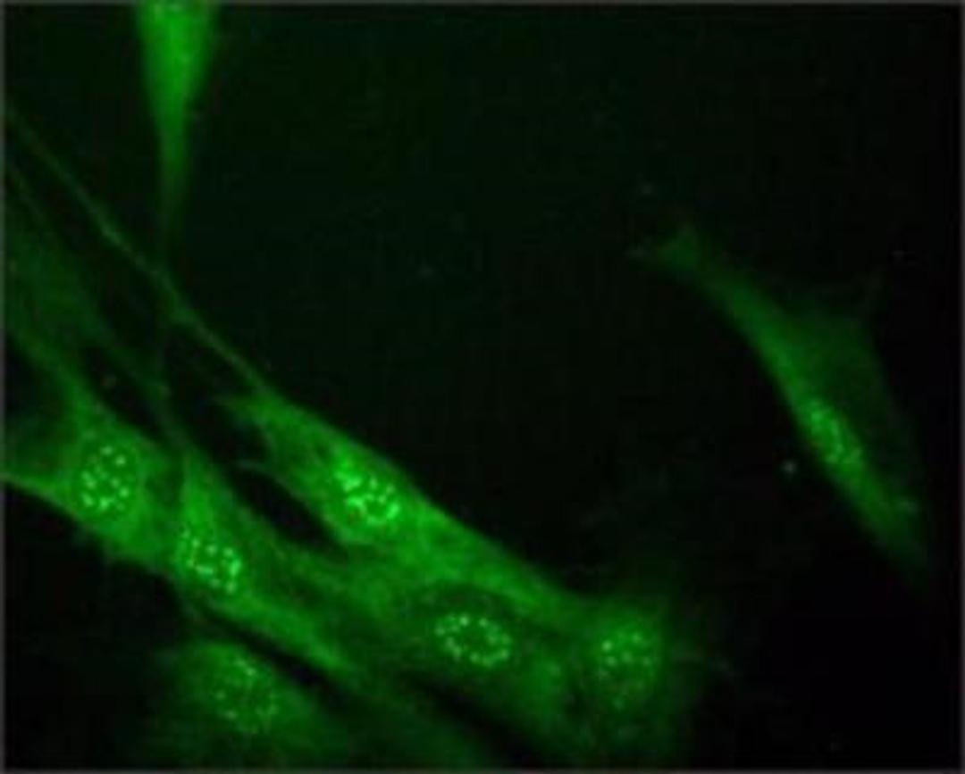 Immunocytochemistry/Immunofluorescence: SC35 Antibody (SC-35) [NB100-1774] - HS-68 cells were fixed and permeabilized with 4% Paraformaldehyde and 0.5% Triton X-100. Fixed cells were stained with Mouse Anti-Splicing Factor Clone: SC-35 diluted to 1:2,000. The antibody was developed using Goat Anti-Mouse IgG, FITC-conjugate.