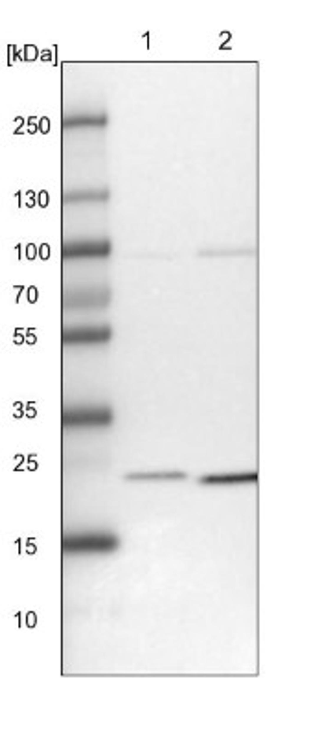 Western Blot: UQCC Antibody [NBP1-90766] - Lane 1: NIH-3T3 cell lysate (Mouse embryonic fibroblast cells)<br/>Lane 2: NBT-II cell lysate (Rat Wistar bladder tumour cells)