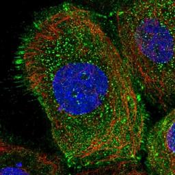 Immunocytochemistry/Immunofluorescence: DENND1C Antibody [NBP1-94052] - Staining of human cell line A-431 shows positivity in plasma membrane & focal adhesions.