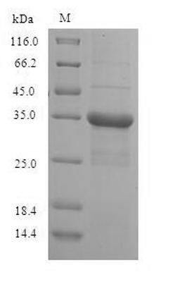 (Tris-Glycine gel) Discontinuous SDS-PAGE (reduced) with 5% enrichment gel and 15% separation gel.