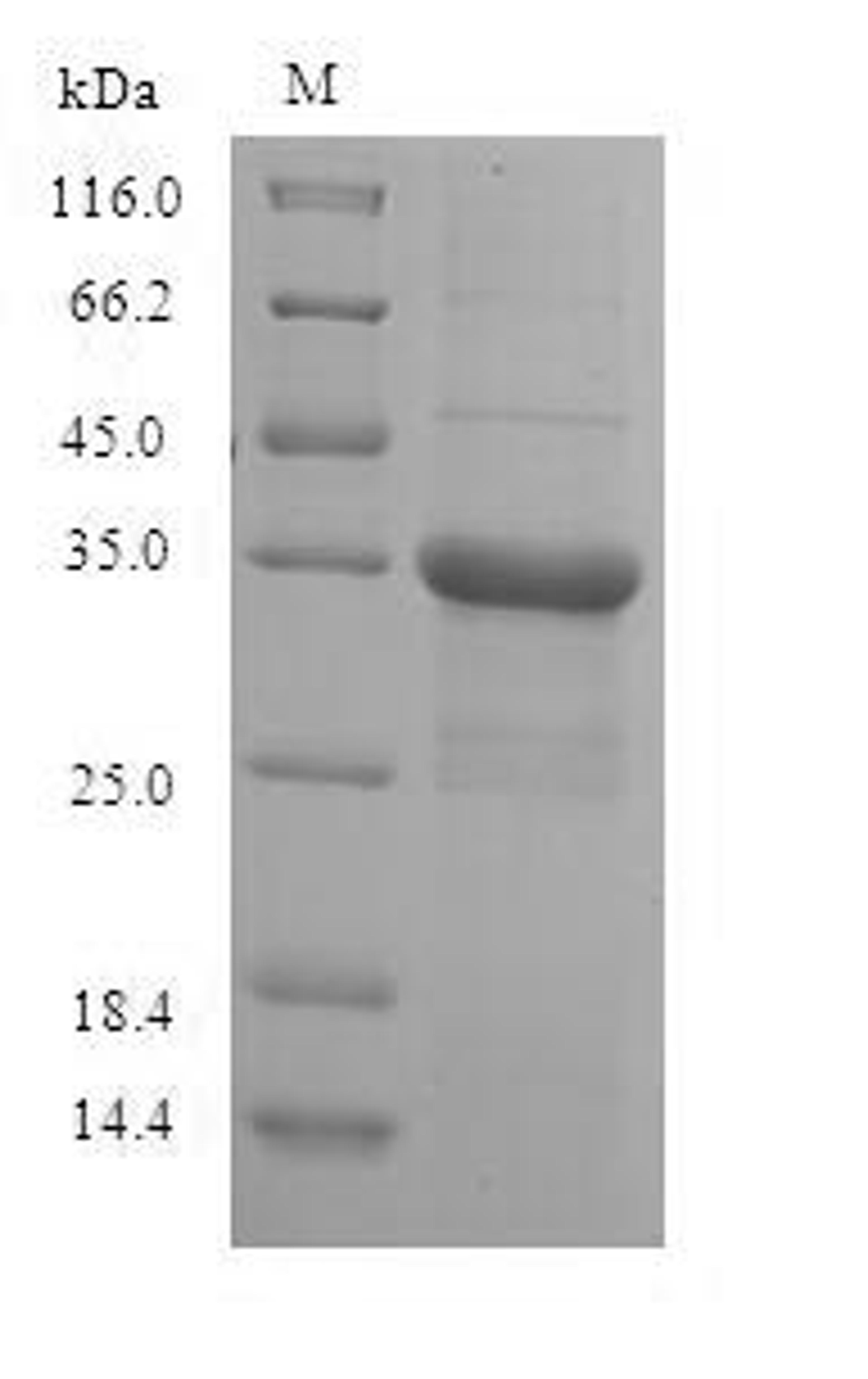 (Tris-Glycine gel) Discontinuous SDS-PAGE (reduced) with 5% enrichment gel and 15% separation gel.
