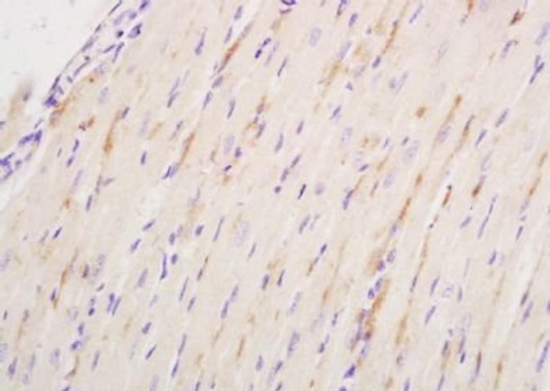 Immunohistochemical staining of mouse heart tissue using NPRA antibody.