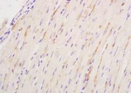 Immunohistochemical staining of mouse heart tissue using NPRA antibody.