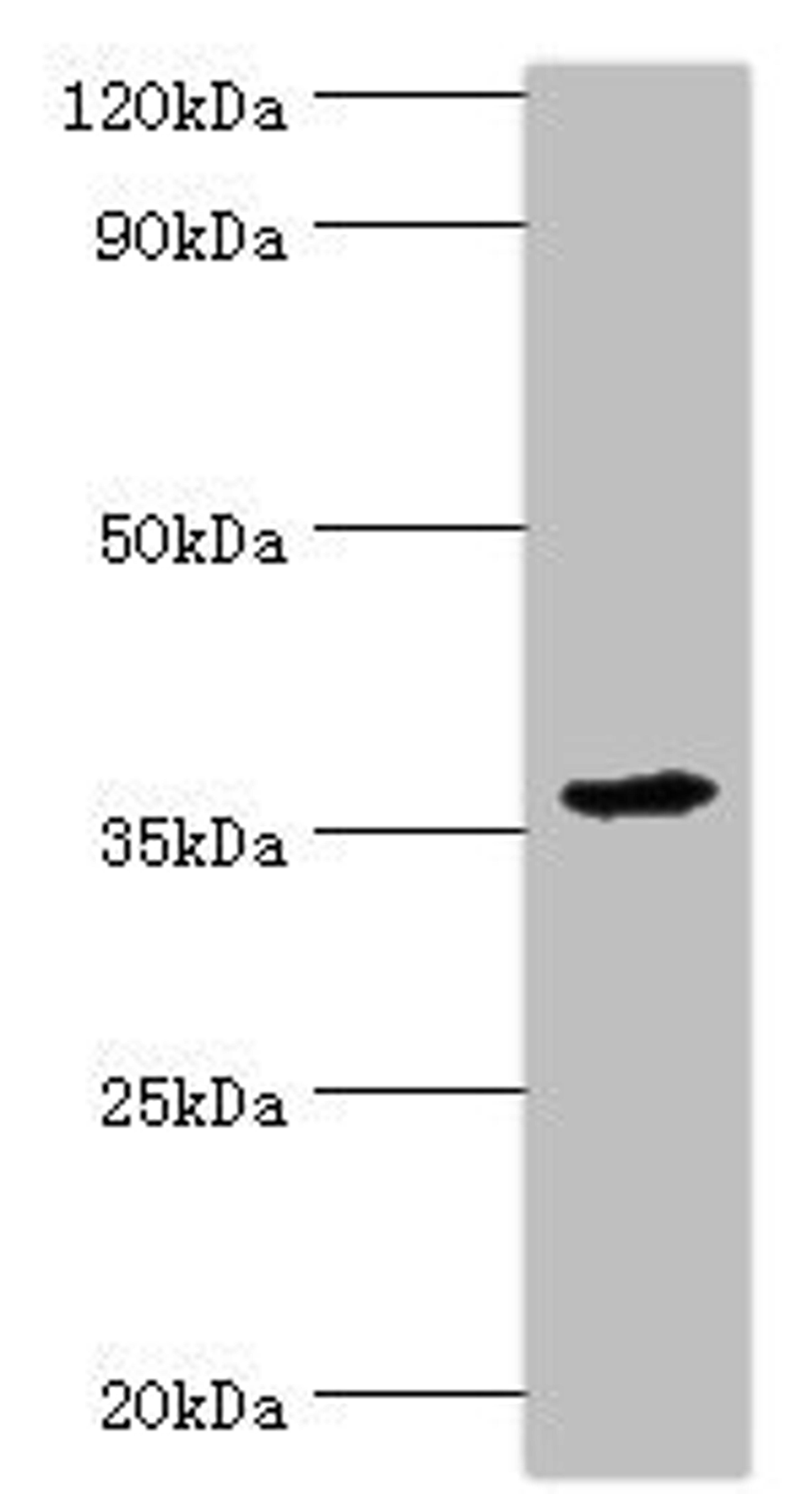 Western blot. All lanes: PDZ and LIM domain protein 1 antibody at 10ug/ml + Mouse lung tissue. Secondary. Goat polyclonal to rabbit IgG at 1/10000 dilution. Predicted band size: 36 kDa. Observed band size: 36 kDa. 