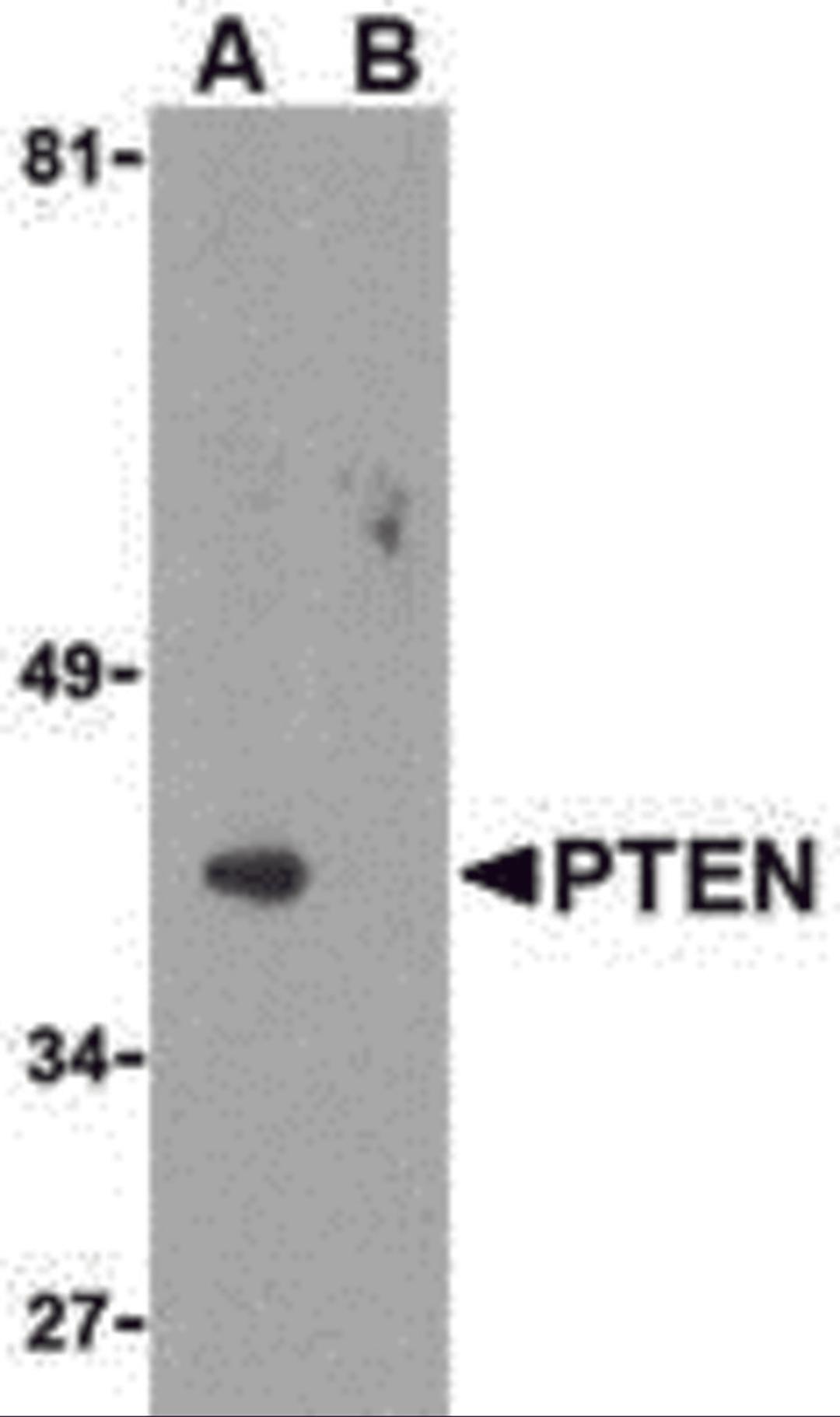 Western blot analysis of PTEN in PC-3 cell lysate with PTEN antibody at 1 μg/mL in either the (A) absence or (B) presence of blocking peptide.