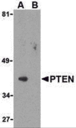Western blot analysis of PTEN in PC-3 cell lysate with PTEN antibody at 1 μg/mL in either the (A) absence or (B) presence of blocking peptide.