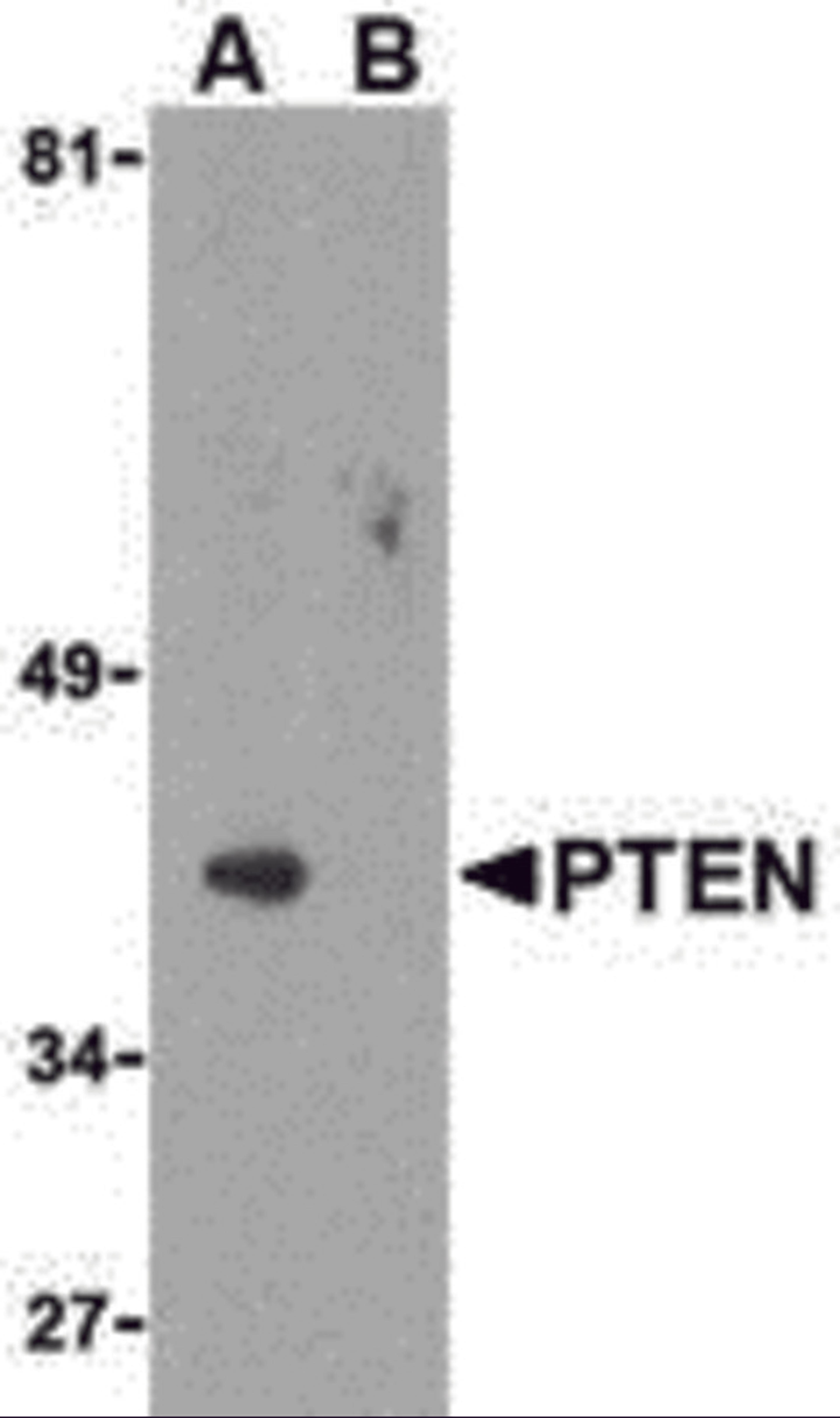 Western blot analysis of PTEN in PC-3 cell lysate with PTEN antibody at 1 μg/mL in either the (A) absence or (B) presence of blocking peptide.