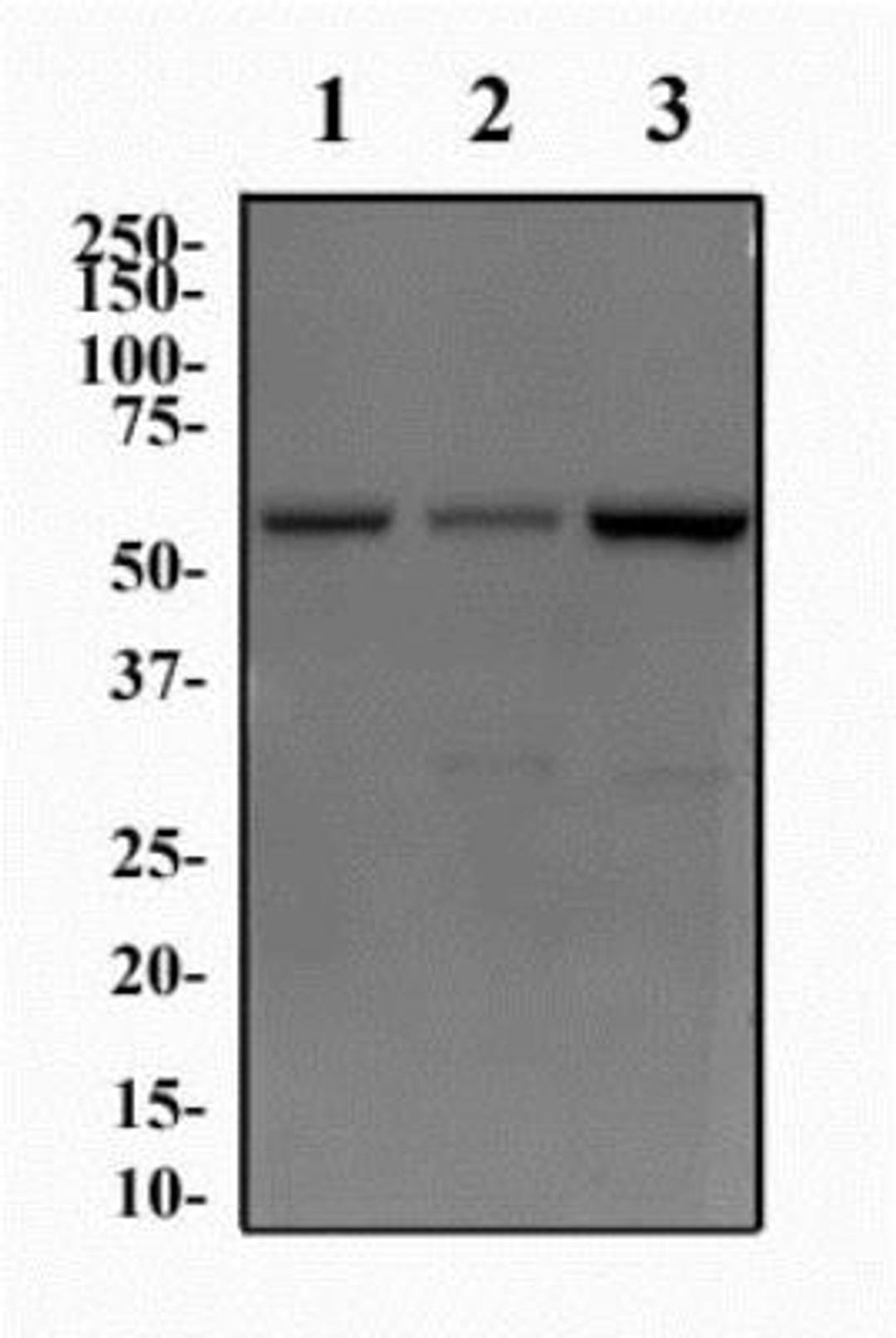 Western Blot: JMJD2D Antibody [NBP1-03357] - Western Blot Image of anti-JMJD2D. Whole cell protein from PC3 (lane 1), SHSY5Y (lane 2), and HeLa (lane 3) was separated on a 12% gel by SDS-PAGE, transferred to PVDF membrane and blocked in 5% non-fat milk in TBST. The membrane was probed with 2.0 ug/ml anti-JMJD2D in 1% milk, and detected with an anti-rabbit HRP secondary antibody using chemiluminescence.