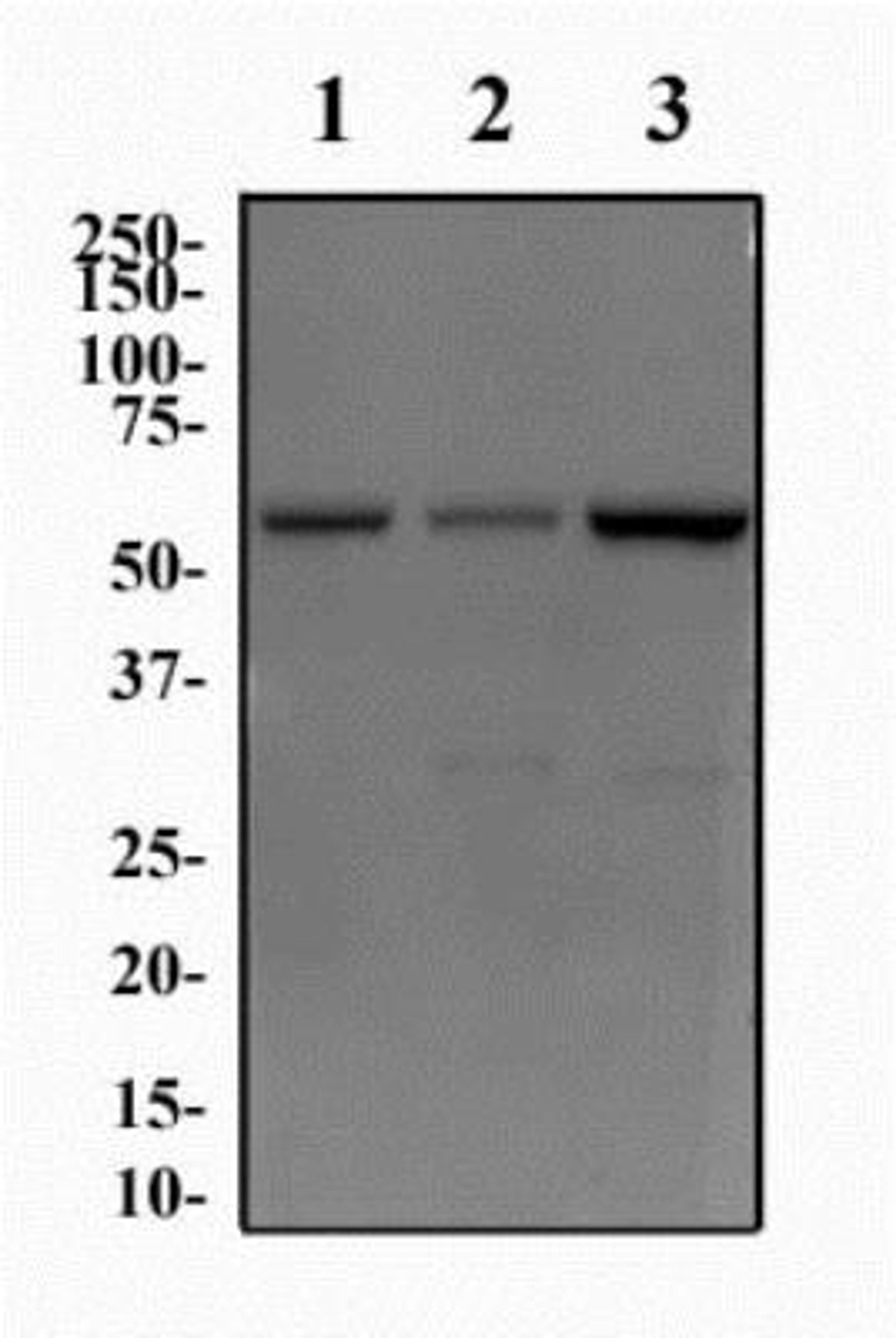 Western Blot: JMJD2D Antibody [NBP1-03357] - Western Blot Image of anti-JMJD2D. Whole cell protein from PC3 (lane 1), SHSY5Y (lane 2), and HeLa (lane 3) was separated on a 12% gel by SDS-PAGE, transferred to PVDF membrane and blocked in 5% non-fat milk in TBST. The membrane was probed with 2.0 ug/ml anti-JMJD2D in 1% milk, and detected with an anti-rabbit HRP secondary antibody using chemiluminescence.