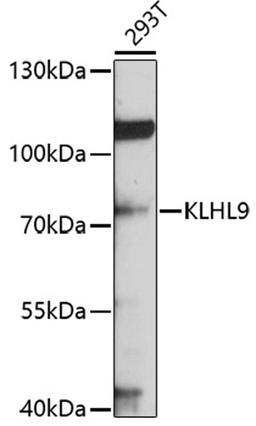 Western blot - KLHL9 antibody (A10149)