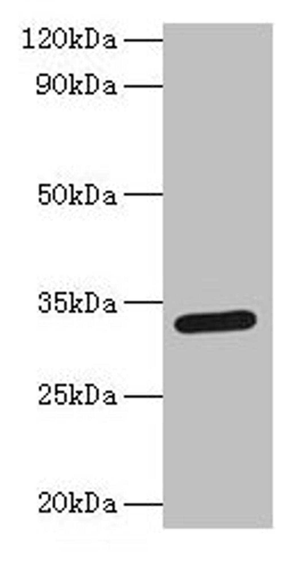 Western blot. All lanes: Spp1 antibody at 2µg/ml + Mouse kidney tissue. Secondary. Goat polyclonal to rabbit IgG at 1/15000 dilution. Predicted band size: 33 kDa. Observed band size: 33 kDa
