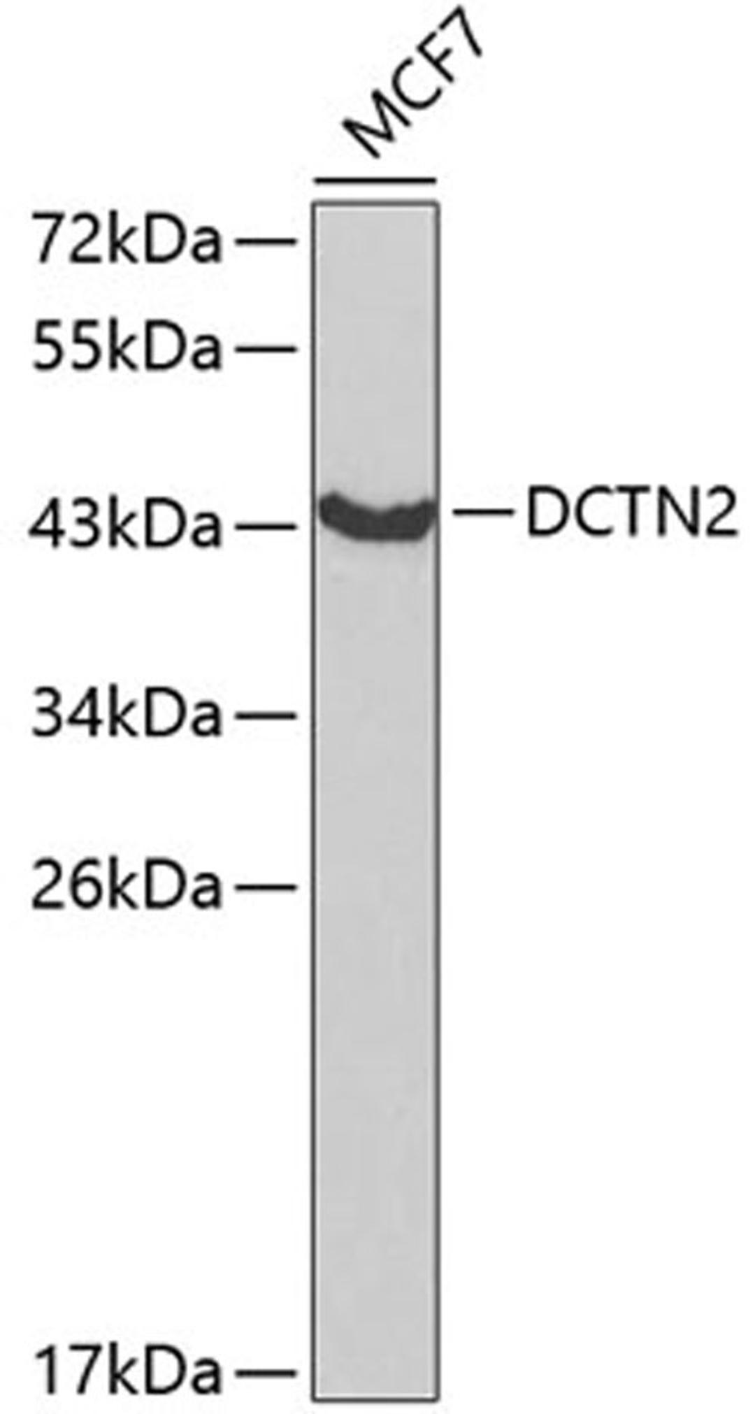 Western blot - DCTN2 antibody (A2200)