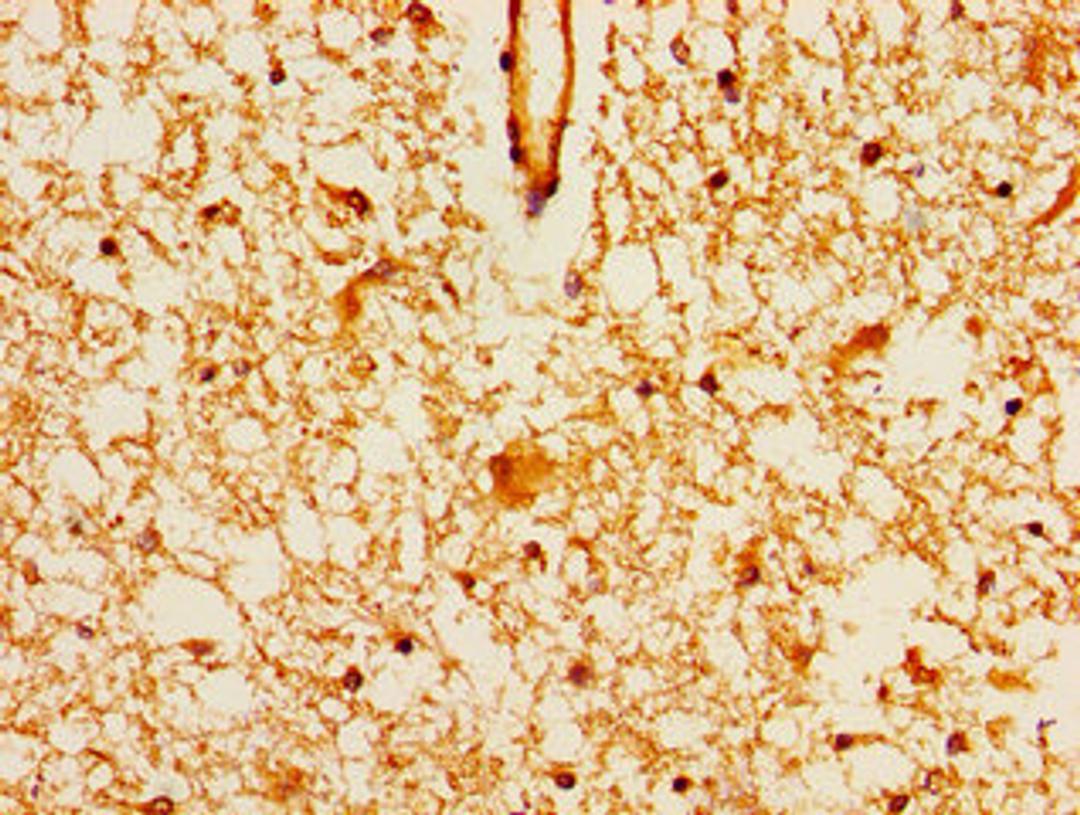 Immunohistochemistry of paraffin-embedded human brain tissue using CSB-PA771436LA01HU at dilution of 1:100