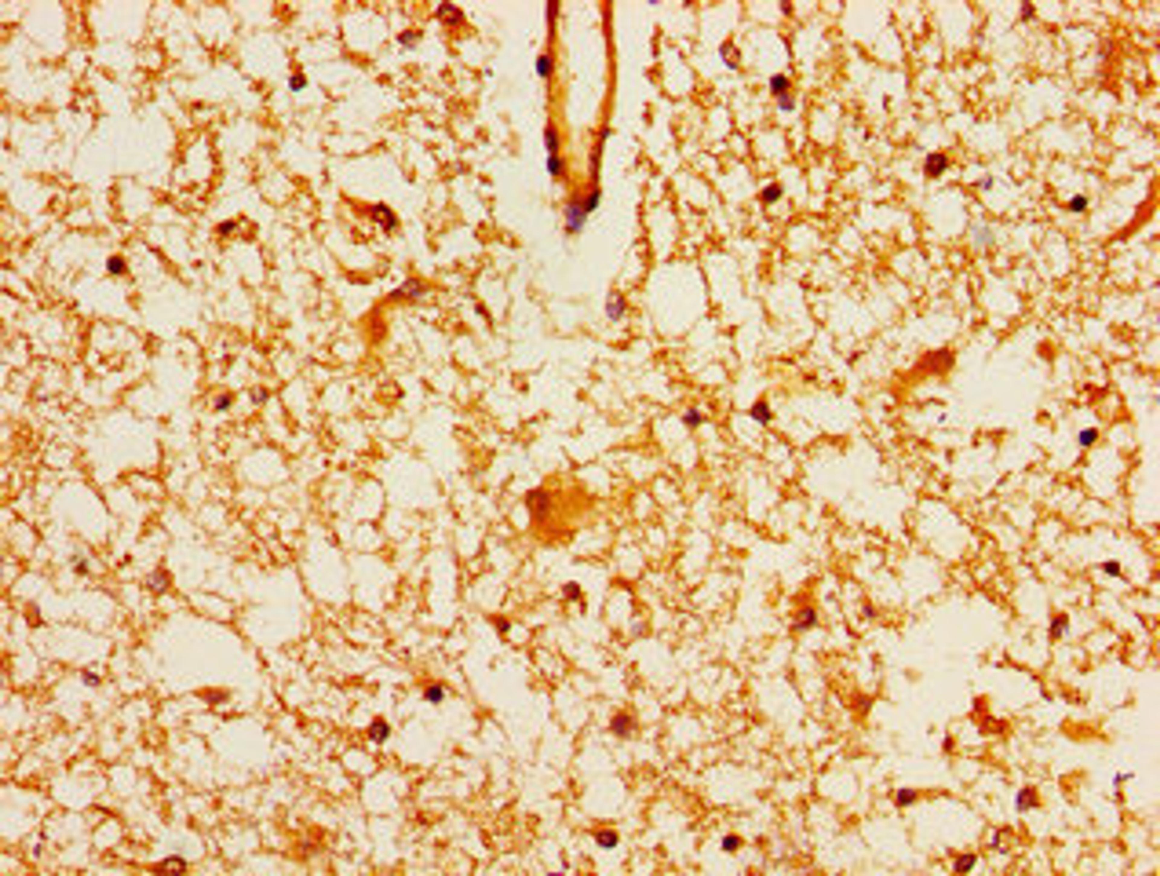Immunohistochemistry of paraffin-embedded human brain tissue using CSB-PA771436LA01HU at dilution of 1:100