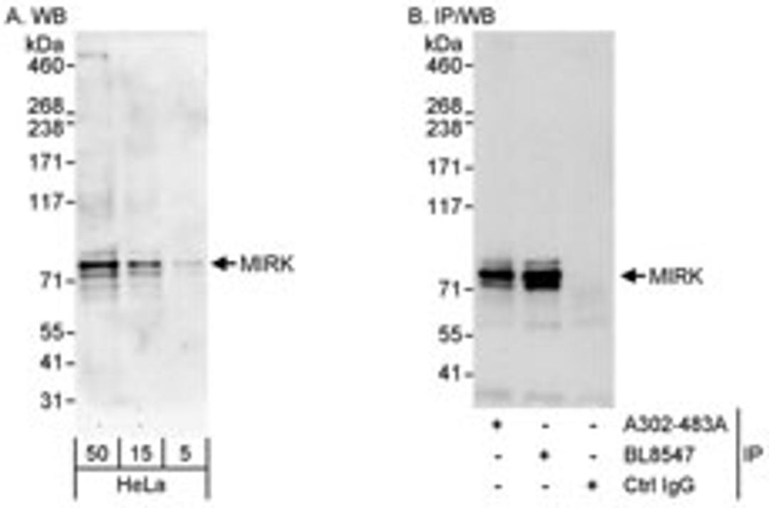 Detection of human MIRK by western blot and immunoprecipitation.