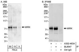 Detection of human MIRK by western blot and immunoprecipitation.