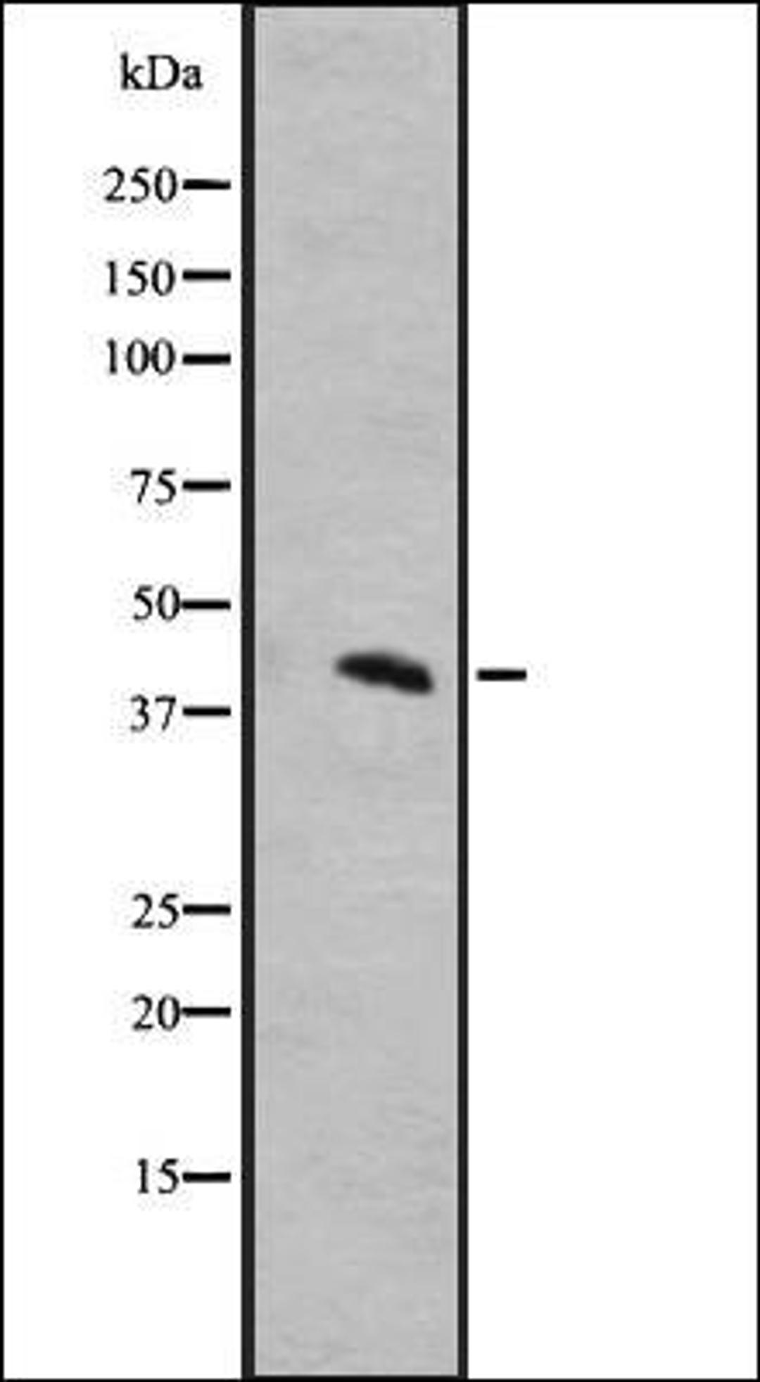 Western blot analysis of A431 whole cell lysate using MRGRD antibody