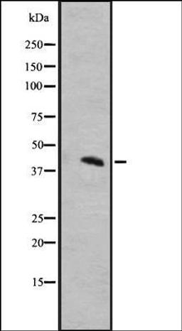 Western blot analysis of A431 whole cell lysate using MRGRD antibody