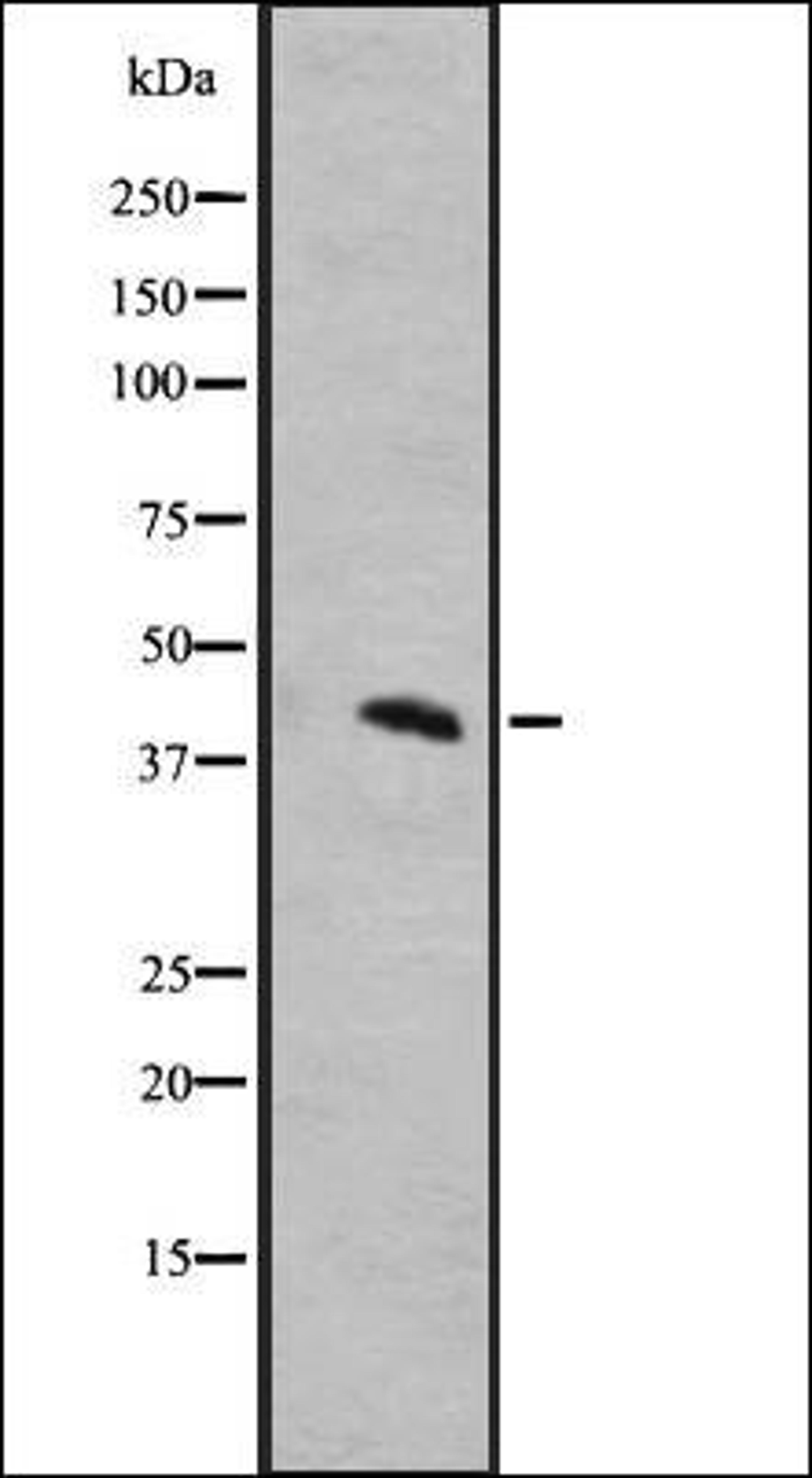 Western blot analysis of A431 whole cell lysate using MRGRD antibody