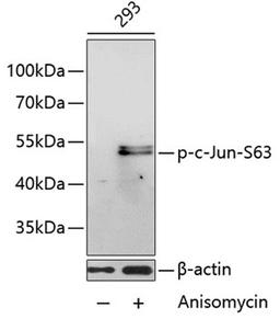 Western blot - Phospho-c-Jun-S63 antibody (AP0048)