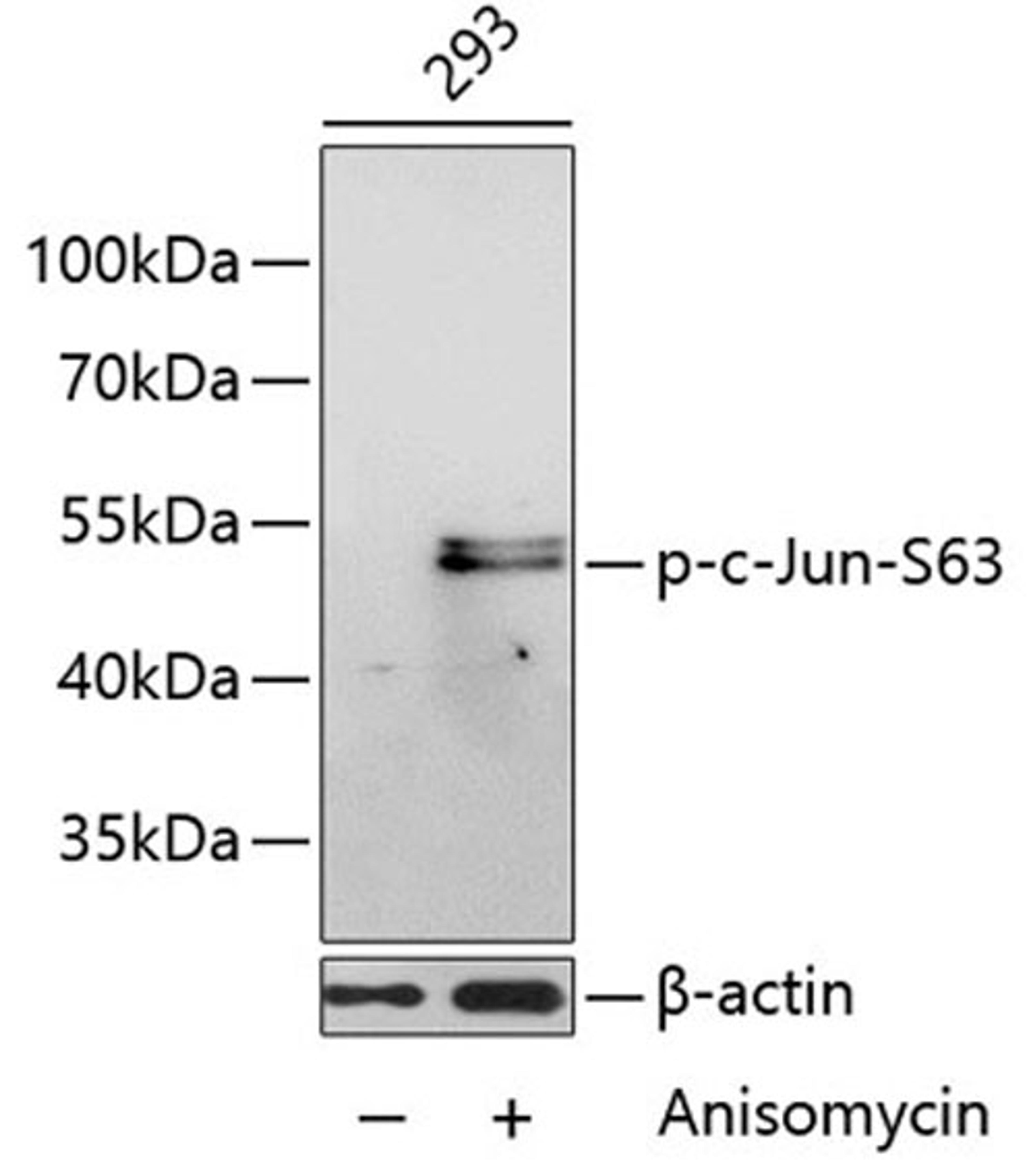 Western blot - Phospho-c-Jun-S63 antibody (AP0048)