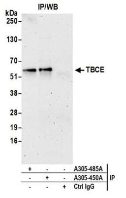 Detection of human TBCE by western blot of immunoprecipitates.