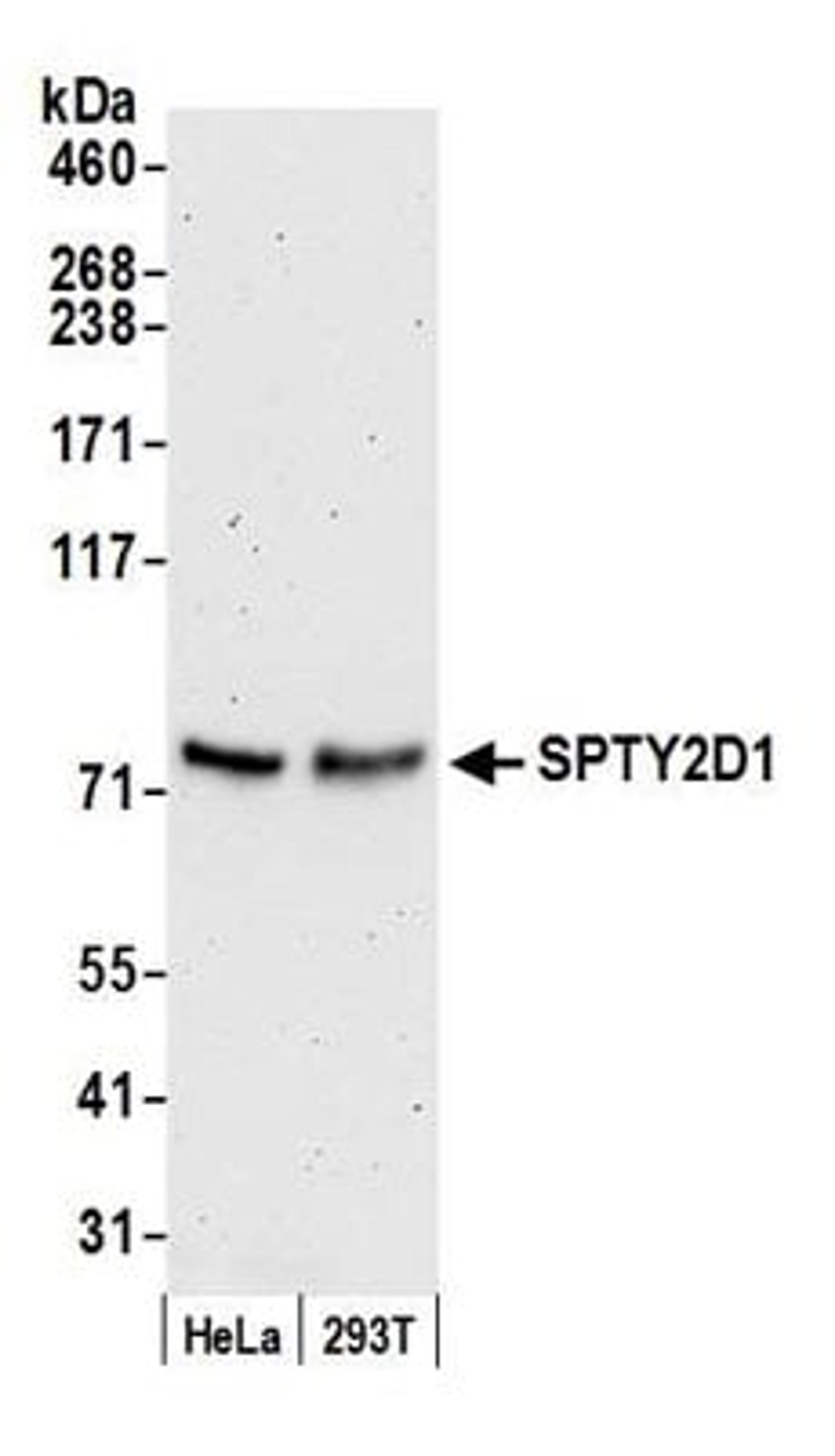 Detection of human SPTY2D1 by western blot.