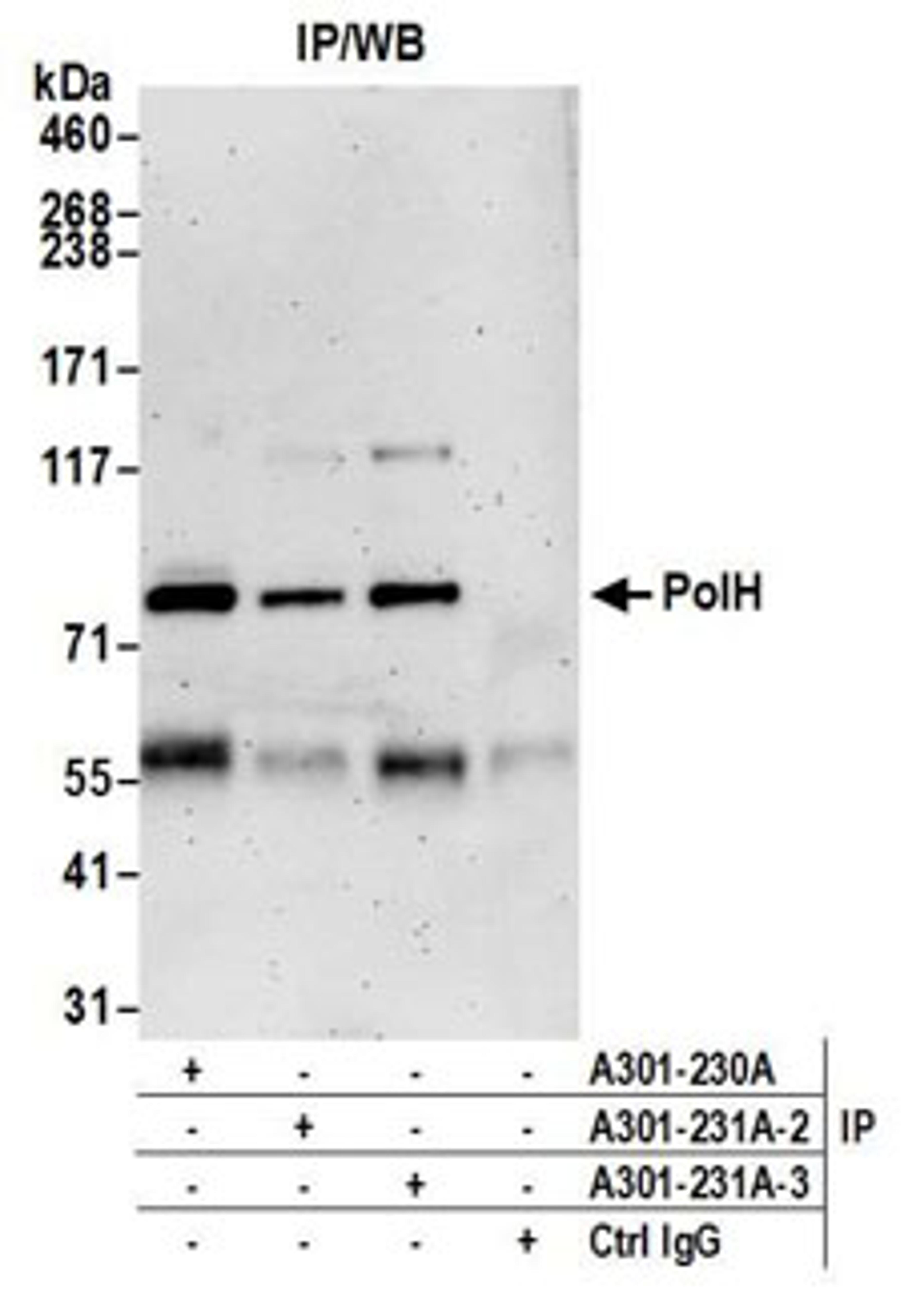 Detection of human PolH by western blot of immunoprecipitates.