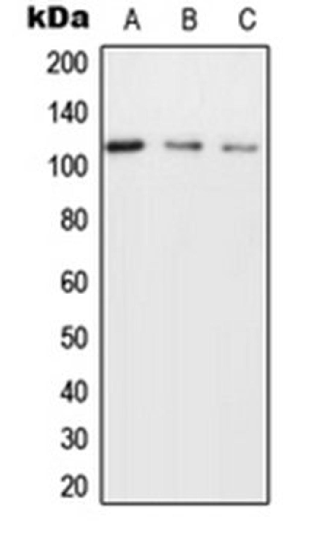 Western blot analysis of MCF7 (Lane 1), SP2/0 (Lane 2), H9C2 (Lane 3) whole cell lysates using UBAP2L antibody