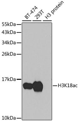 Western blot - Acetyl-Histone H3-K18 antibody (A7257)