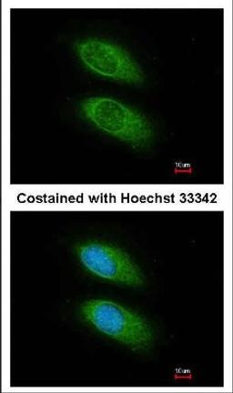 Immunocytochemistry/Immunofluorescence: PLCG 2 Antibody [NBP1-33122] - Methanol-fixed HeLa