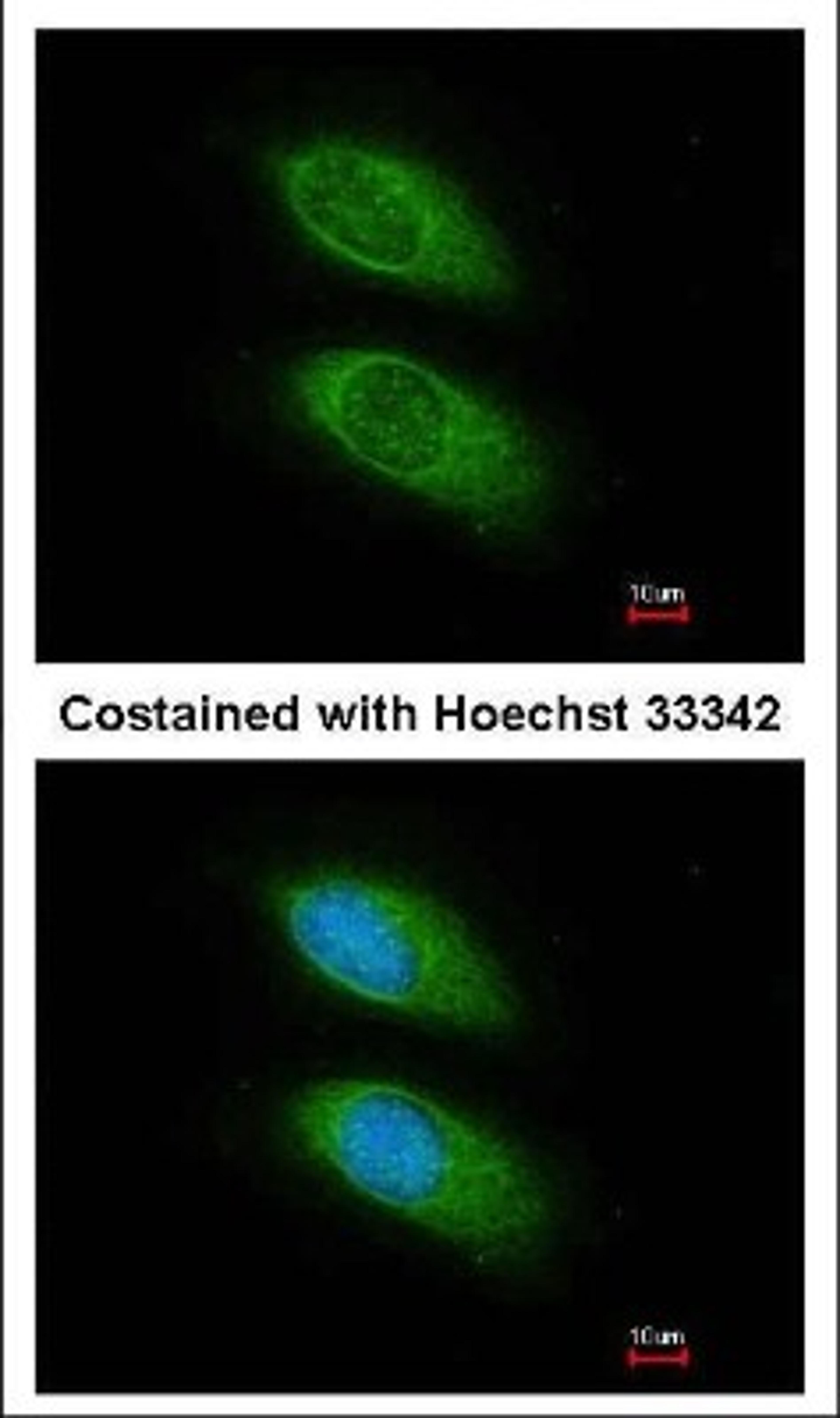 Immunocytochemistry/Immunofluorescence: PLCG 2 Antibody [NBP1-33122] - Methanol-fixed HeLa