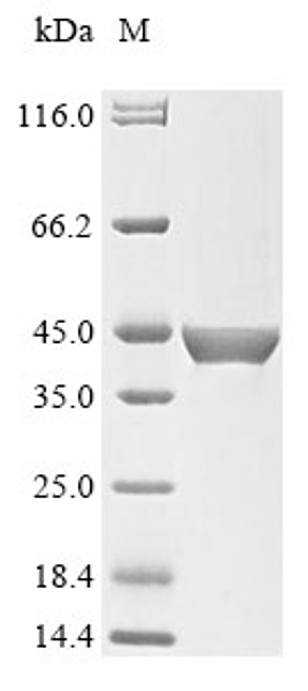 (Tris-Glycine gel) Discontinuous SDS-PAGE (reduced) with 5% enrichment gel and 15% separation gel.