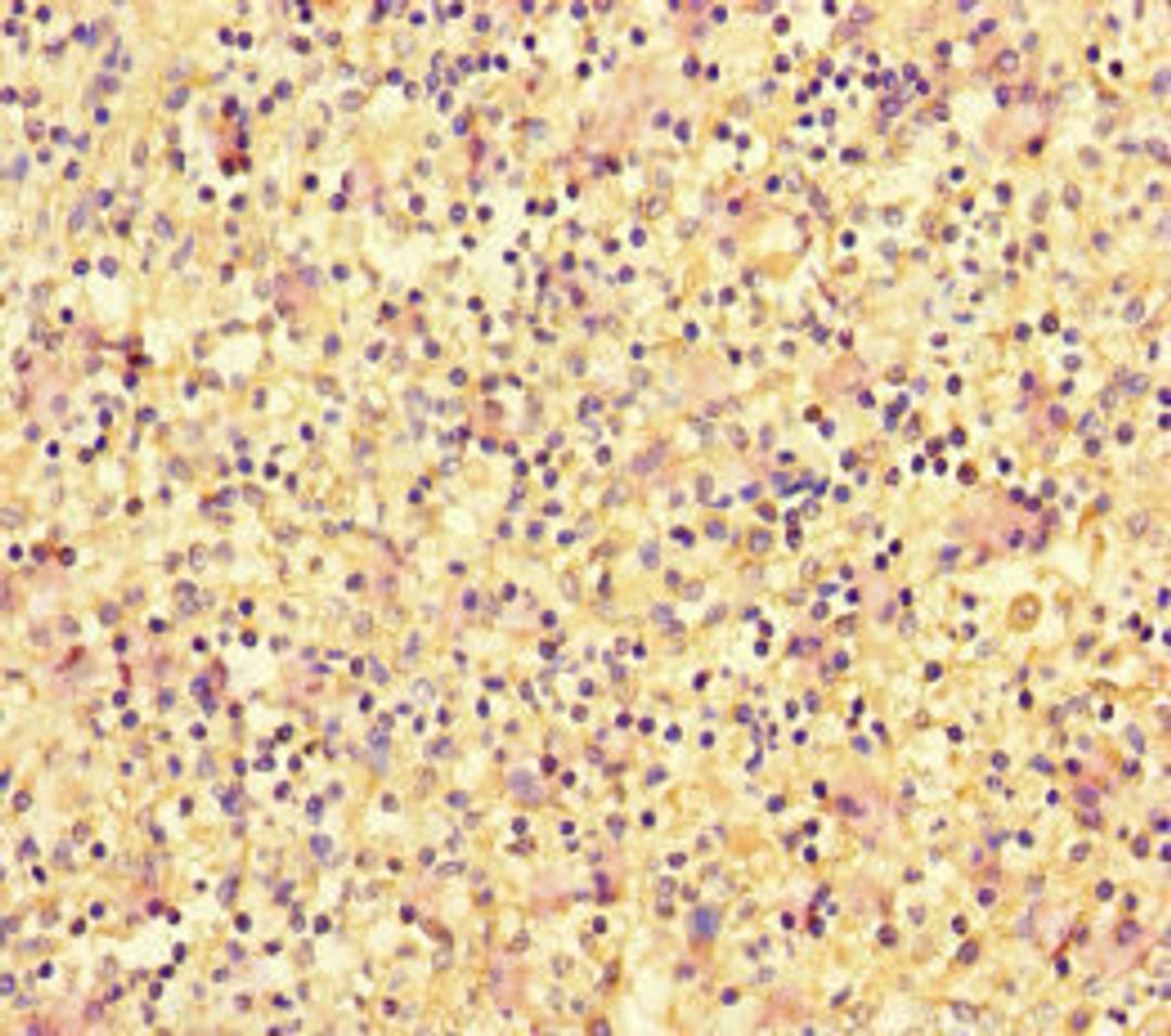 Immunohistochemistry of paraffin-embedded human spleen tissue using CSB-PA007108LA01HU at dilution of 1:100