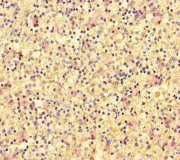 Immunohistochemistry of paraffin-embedded human spleen tissue using CSB-PA007108LA01HU at dilution of 1:100