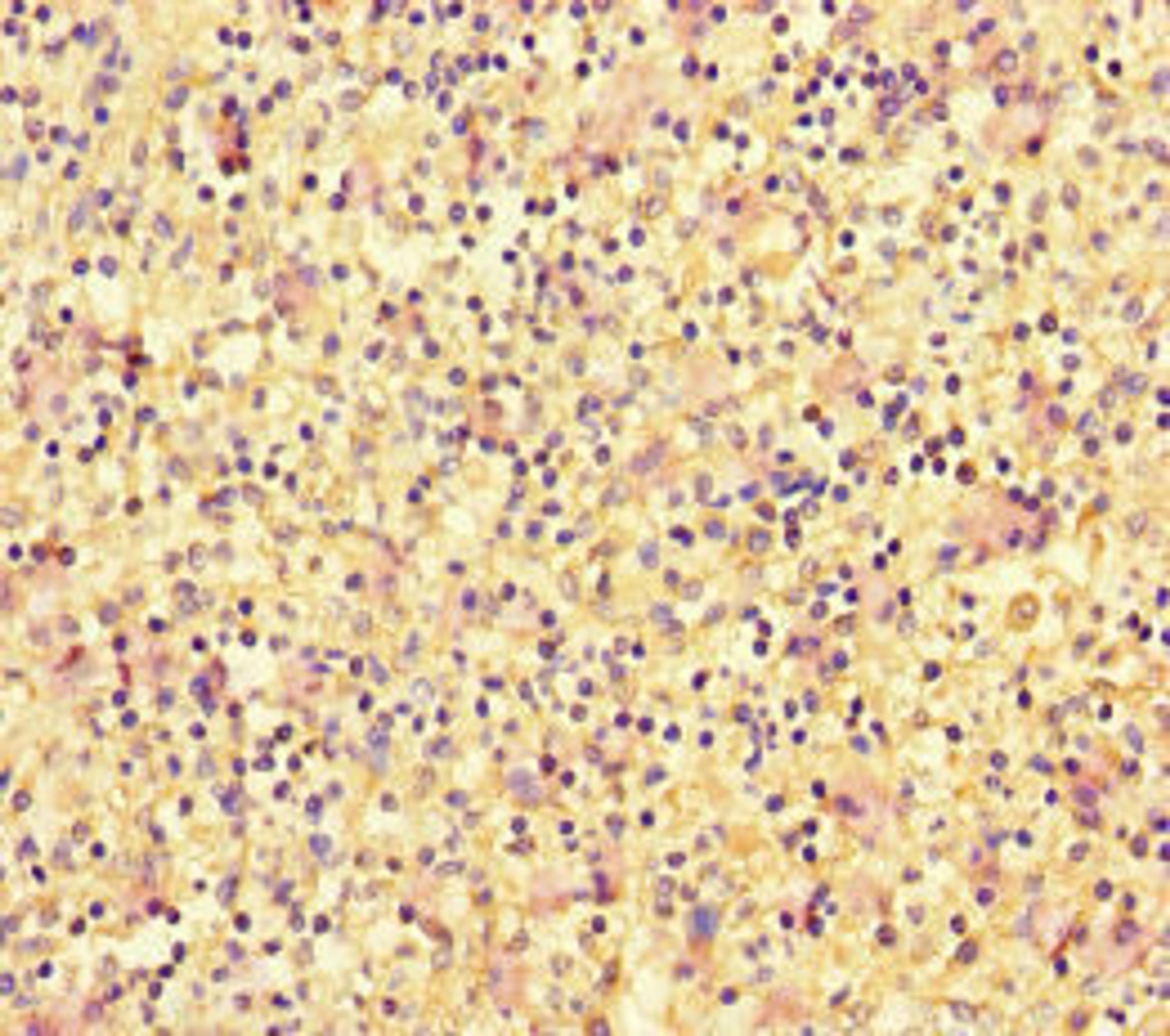 Immunohistochemistry of paraffin-embedded human spleen tissue using CSB-PA007108LA01HU at dilution of 1:100