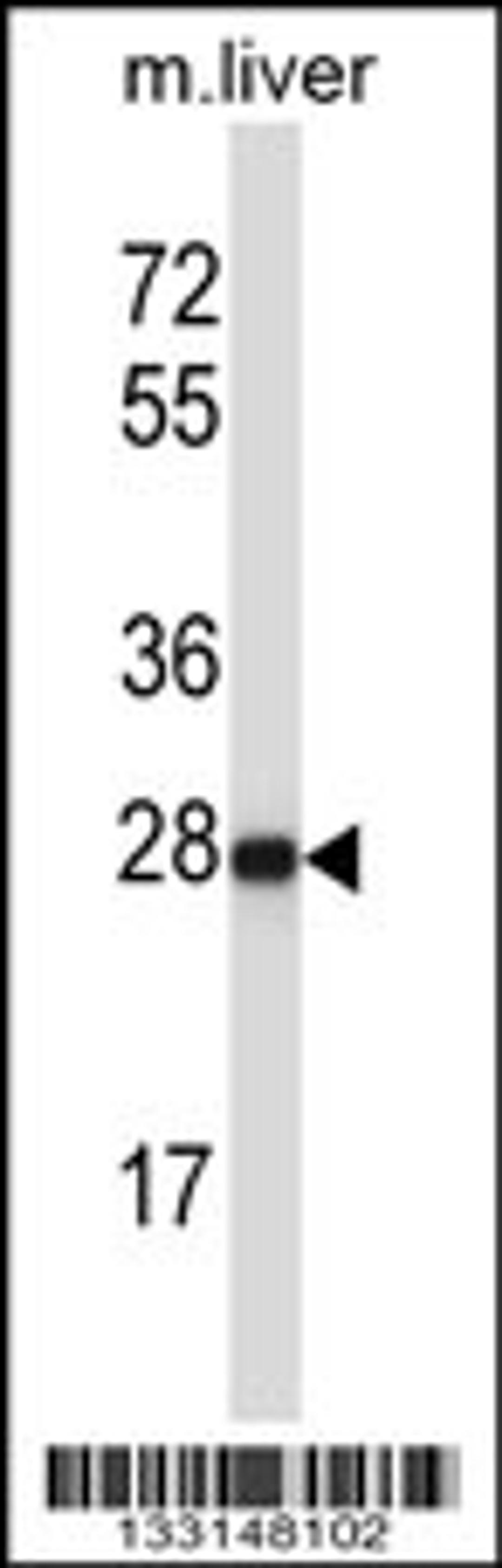 Western blot analysis in mouse liver tissue lysates (35ug/lane).